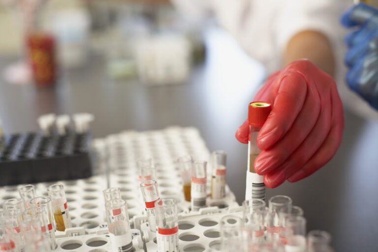 11 вида рак са все по-често срещани при младите хора