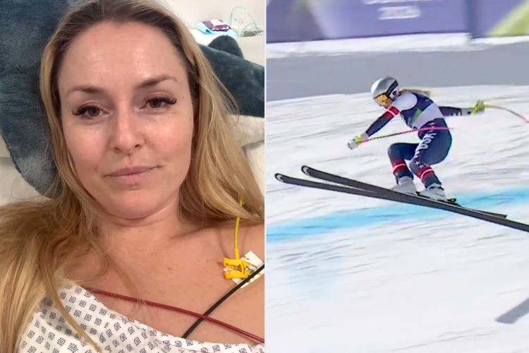 Линдзи Вон ще се нуждае от поне пет операции след падането на Олимпийските игри