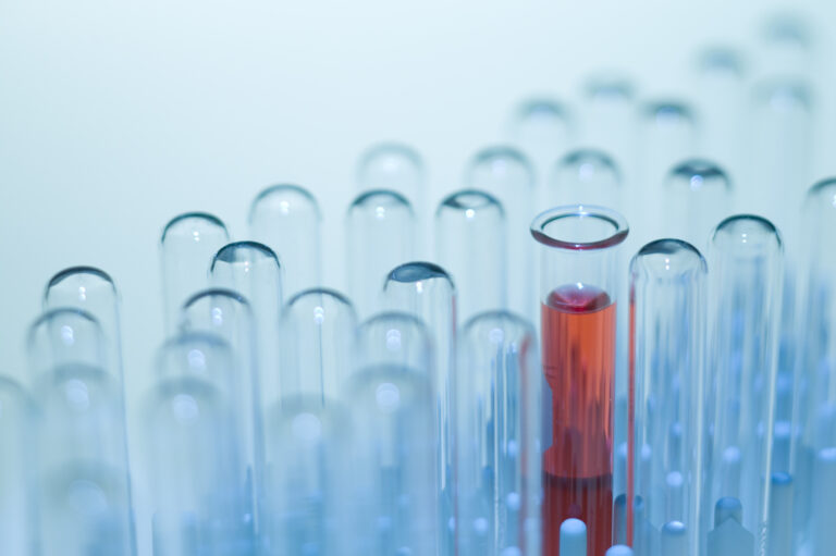 Кръвен тест може да промени картината на сърдечносъдовите заболявания в България